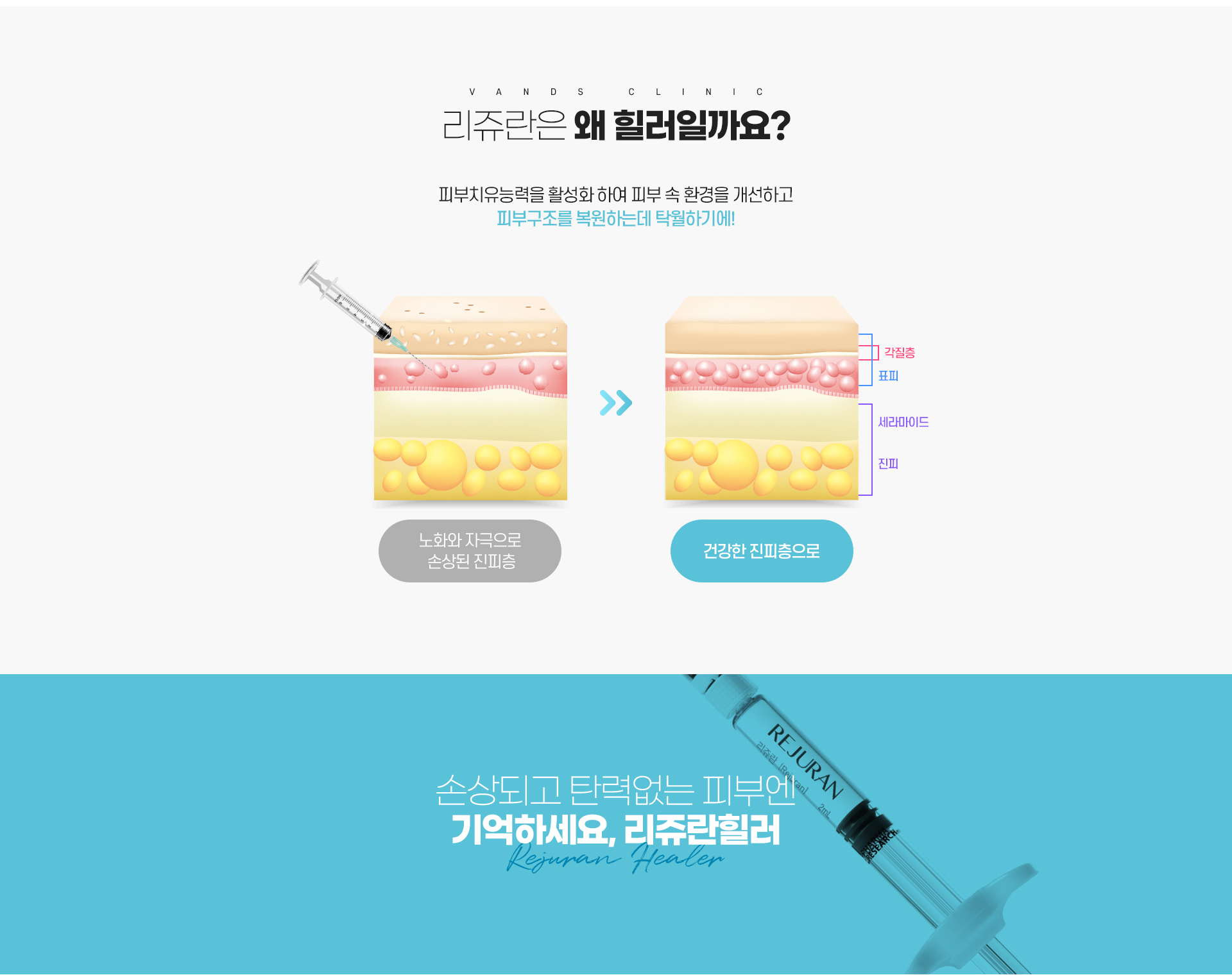리쥬란힐러 시술안내 이미지2