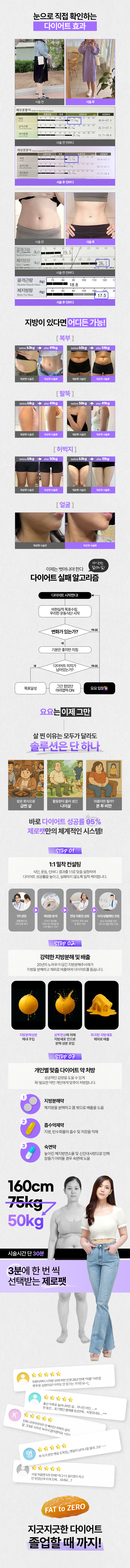 제로팻 바디 시술안내 이미지2